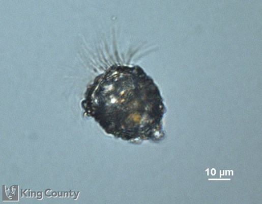 Photo of Tintinnopsis